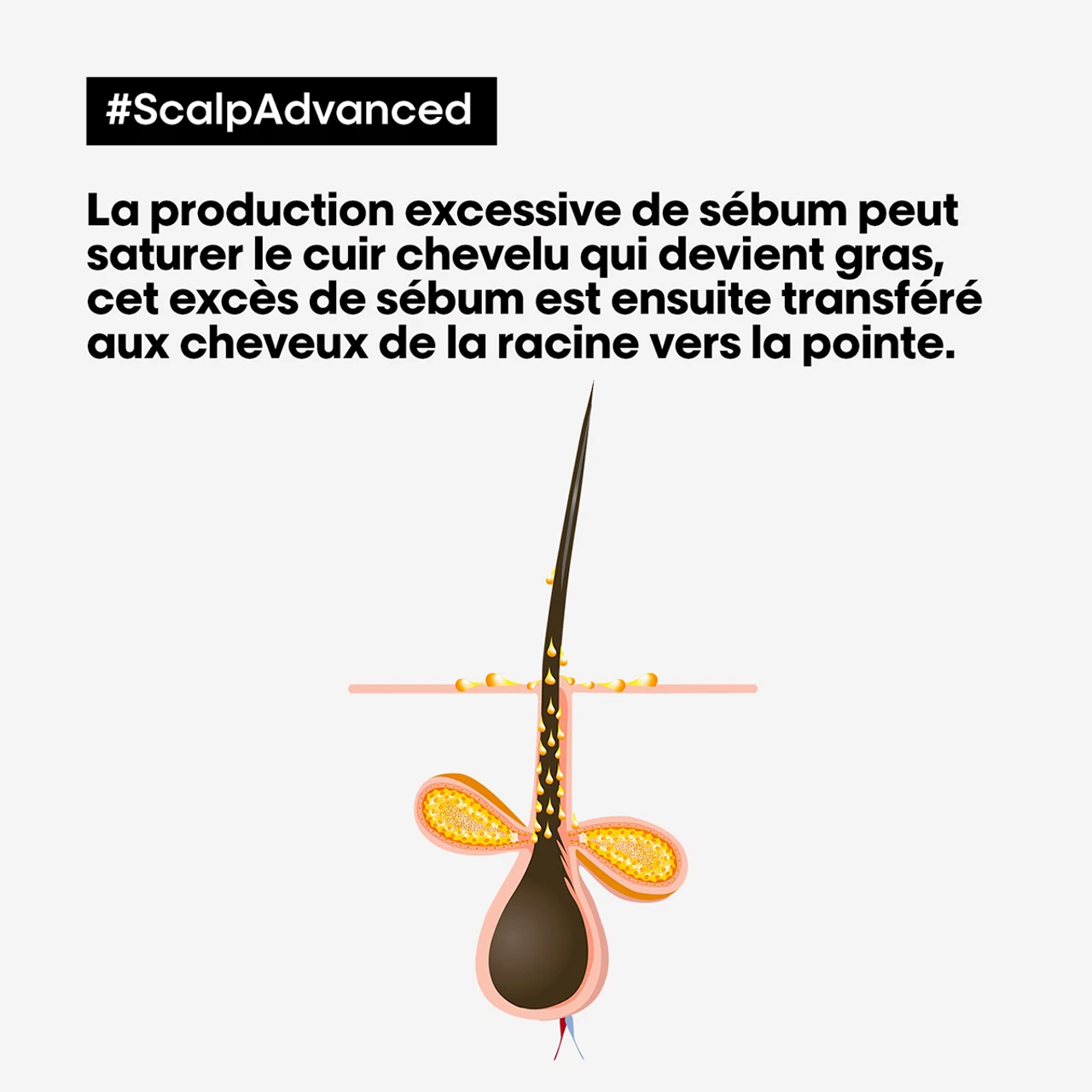 Argile 2-en-1 Purifiante Anti Gras Scalp Advanced L'Oréal 500ml 5 Argile 2-en-1 Purifiante Anti Gras Scalp Advanced L'Oréal 500ml – Image 3